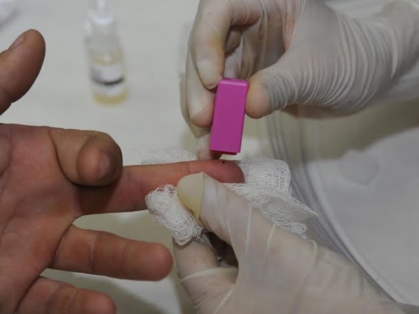 Epidemia estabilizada no brasil HIV/Aids