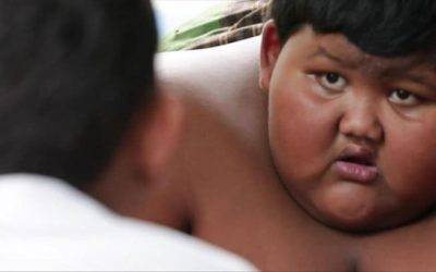 Menino indonésio com 192kg tem apenas 10 anos