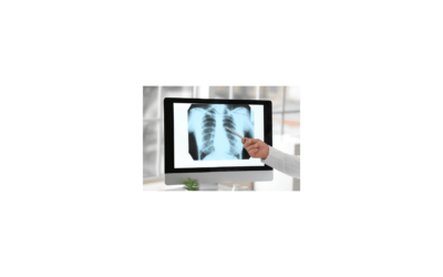 Pneumologia e a respiração