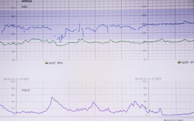 Isquemia do Miocárdio: Como identificar os sinais de alerta e buscar ajuda médica